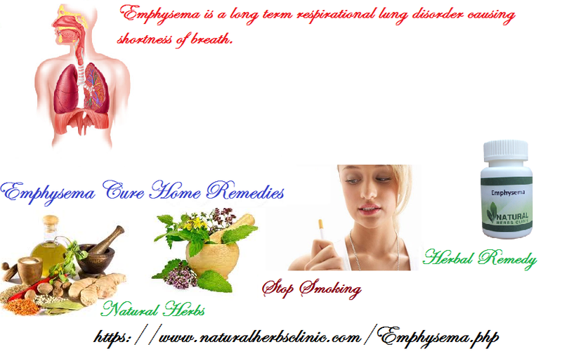 Illustration for article titled Emphysema Cure Home Remedies